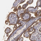 Immunohistochemical staining of human placenta shows strong cytoplasmic and membranous positivity in trophoblastic cells.