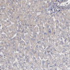 Immunohistochemical staining of human liver shows no positivity in hepatocytes as expected.