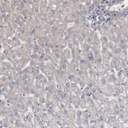 Immunohistochemical staining of human liver shows no positivity in hepatocytes as expected.
