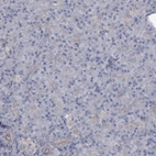 Immunohistochemical staining of human pancreas shows no positivity in exocrine glandular cells as expected.