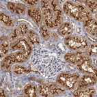 Immunohistochemical staining of human kidney shows moderate to strong positivity in cells in tubules.