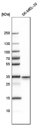 Western blot analysis in human cell line SK-MEL-30.