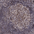 Immunohistochemical staining of human tonsil shows granular cytoplasmic positivity.