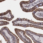 Immunohistochemical staining of human duodenum shows granular cytoplasmic positivity in glandular cells.