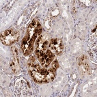 Anti-IGFBP7 Antibody