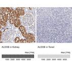 Anti-ALDOB Antibody