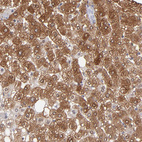 Anti-ALDOB Antibody