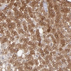 Immunohistochemical staining of human liver shows moderate to strong cytoplasmic positivity in hepatocytes.