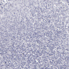 Immunohistochemical staining of human tonsil shows no positivity in lymphoid cells as expected.