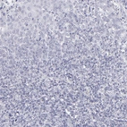 Immunohistochemical staining of human tonsil shows no positivity in lymphoid cells as expected.