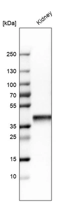 Western blot analysis in human kidney tissue.