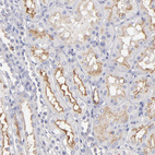 Anti-ABCB1 Antibody