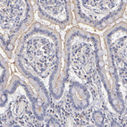 Anti-ABCB1 Antibody