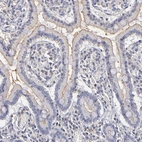 Immunohistochemical staining of human small intestine shows moderate positivity in apical membrane in glandular cells.