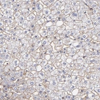Immunohistochemical staining of human liver shows weak membranous positivity in hepatocytes.