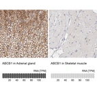 Immunohistochemistry analysis in human adrenal gland and skeletal muscle tissues using HPA002199 antibody. Corresponding ABCB1 RNA-seq data are presented for the same tissues.