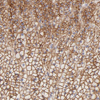 Anti-ABCB1 Antibody