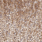 Immunohistochemical staining of human adrenal gland shows strong membranous positivity in glandular cells.