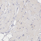 Immunohistochemical staining of human skeletal muscle shows no positivity in myocytes as expected.