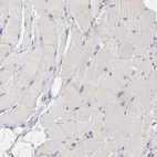 Anti-ABCB1 Antibody