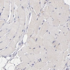 Immunohistochemical staining of human skeletal muscle shows no positivity in myocytes as expected.