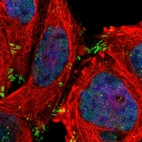 Immunofluorescent staining of human cell line A-431 shows localization to nucleoplasm & focal adhesion sites.