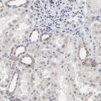 Anti-LNX1 Antibody