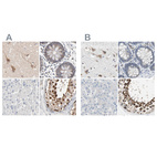 Immunohistochemical staining of human cerebral cortex, colon, liver and testis using Anti-CCT5 antibody HPA002238 (A) shows similar protein distribution across tissues to independent antibody HPA005958 (B).