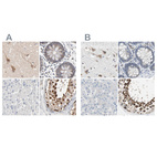 Anti-CCT5 Antibody