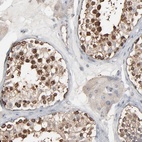 Anti-CCT5 Antibody