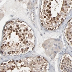 Immunohistochemical staining of human testis shows high expression.