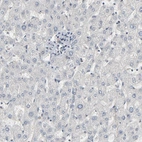 Immunohistochemical staining of human liver shows low expression as expected.