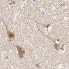 Anti-CCT5 Antibody