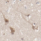 Immunohistochemical staining of human cerebral cortex using Anti-CCT5 antibody HPA002238.