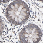Immunohistochemical staining of human colon using Anti-CCT5 antibody HPA002238.