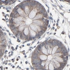 Immunohistochemical staining of human colon using Anti-CCT5 antibody HPA002238.