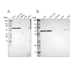 Anti-CCT5 Antibody