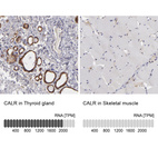 Anti-CALR Antibody