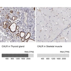 Anti-CALR Antibody