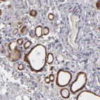 Immunohistochemical staining of human thyroid gland shows strong cytoplasmic positivity in glandular cells.