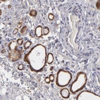 Immunohistochemical staining of human thyroid gland shows strong cytoplasmic positivity in glandular cells.