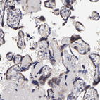 Anti-CALR Antibody