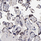Immunohistochemical staining of human placenta shows moderate cytoplasmic positivity in trophoblastic cells.