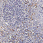 Immunohistochemical staining of human tonsil tissues shows moderate cytoplasmic positivity in non-germinal center cells.