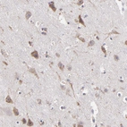 Immunohistochemical staining of human cerebral cortex shows moderate cytoplasmic positivity in neuronal cells.