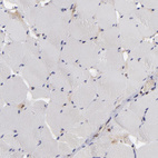 Anti-CALR Antibody