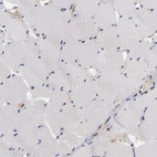 Immunohistochemical staining of human skeletal muscle shows no cytoplasmic positivity in myocytes.