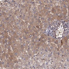 Anti-A2M Antibody