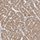 Anti-CCDC80 Antibody