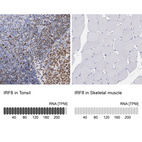 Anti-IRF8 Antibody